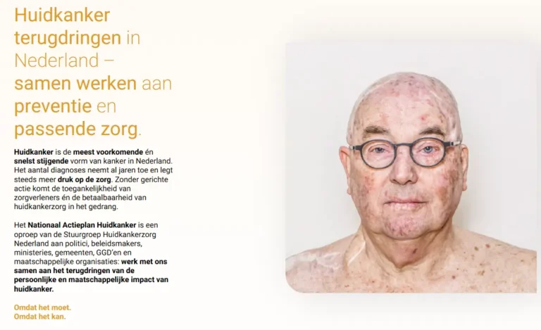 Nationaal actieplan huidkanker