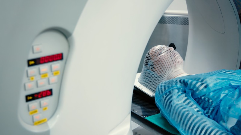 radiotherapie oogmelanoom