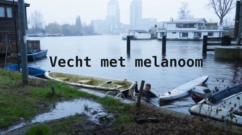 Vecht met melanoom