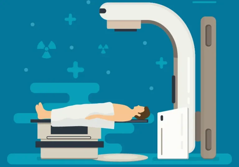 Impact van klachten tijdens radiotherapie groter dan gedacht